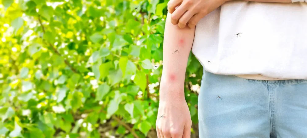 Someone Standing in the Yard Scratching at Mosquito Bites